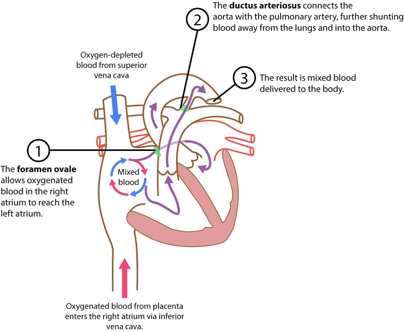 Illustration ur kursen Interprétation de l'ECG pédiatrique et néonatal